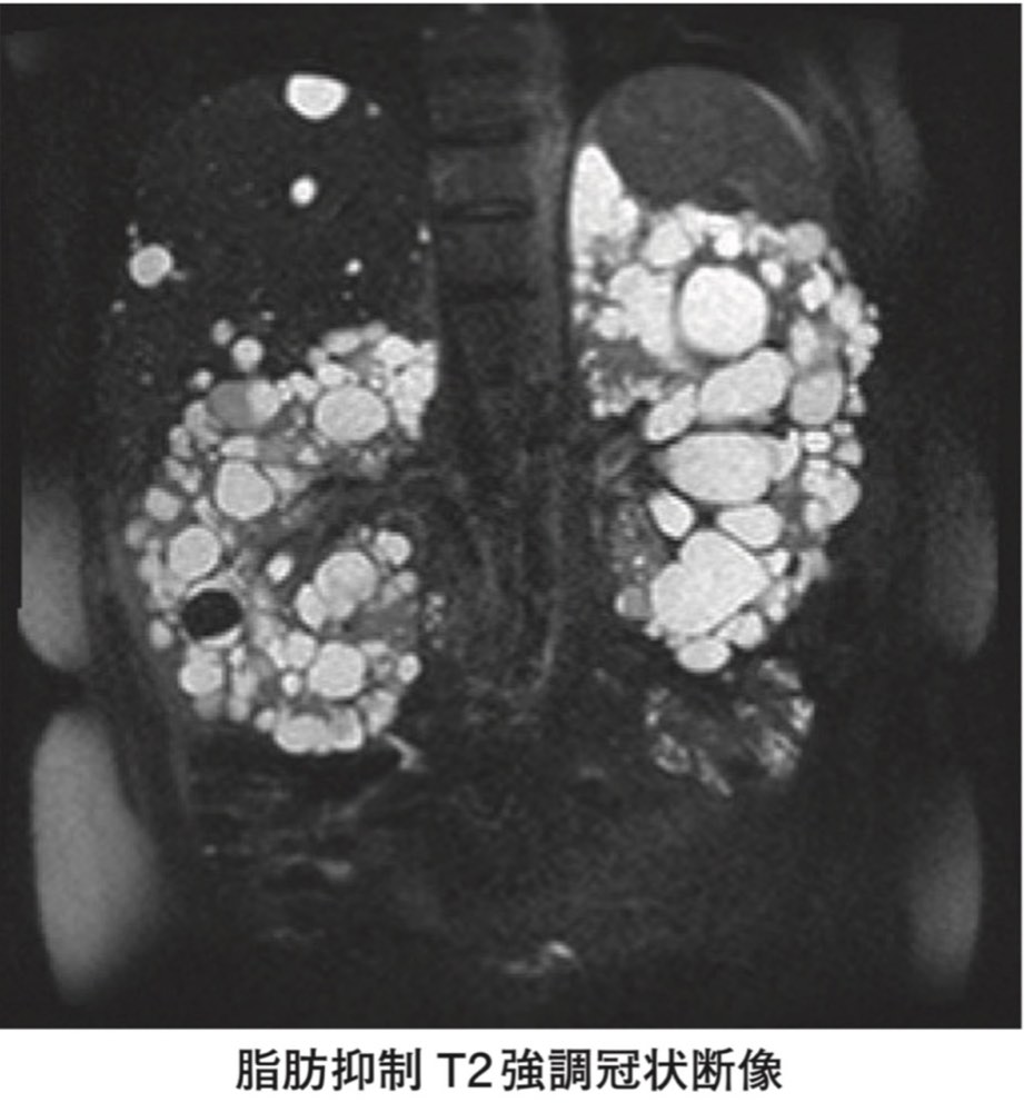 116A22の問題画像