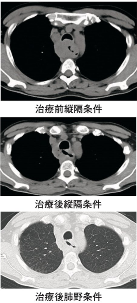 116D37の問題画像