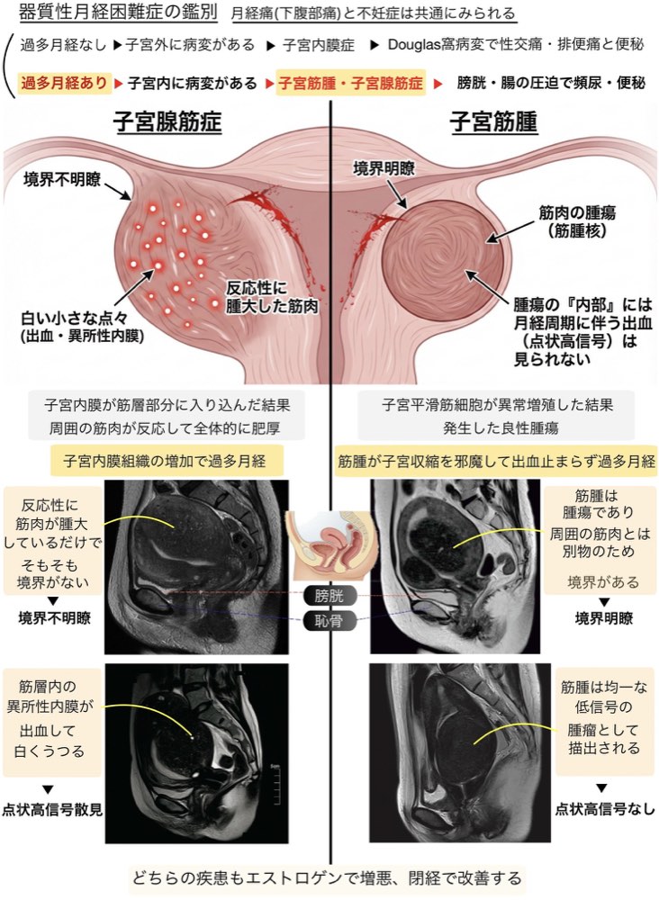115F37の解説画像