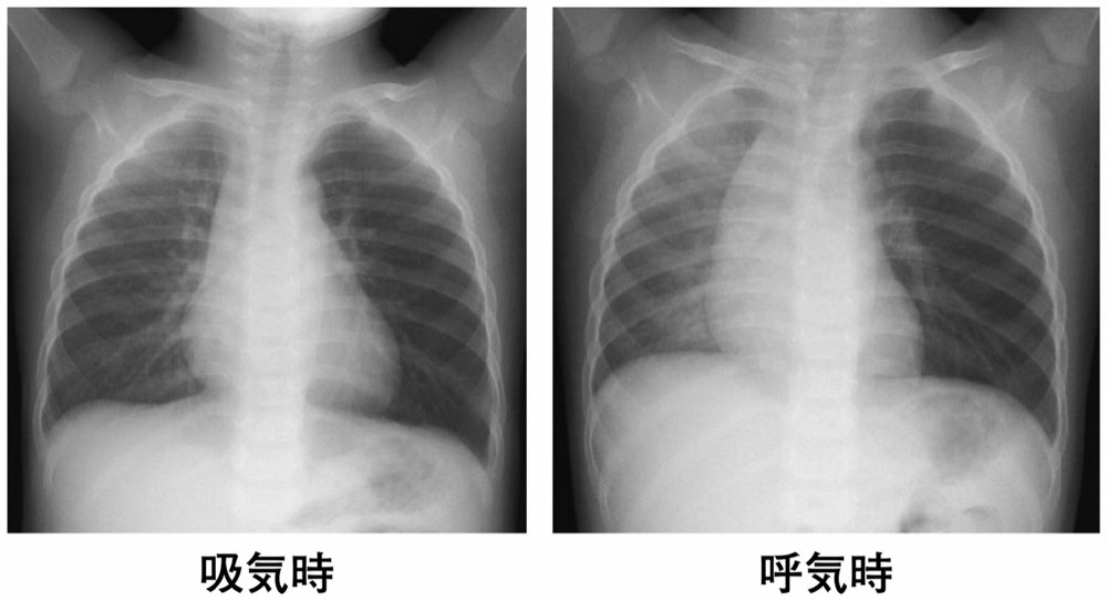112B29の問題画像