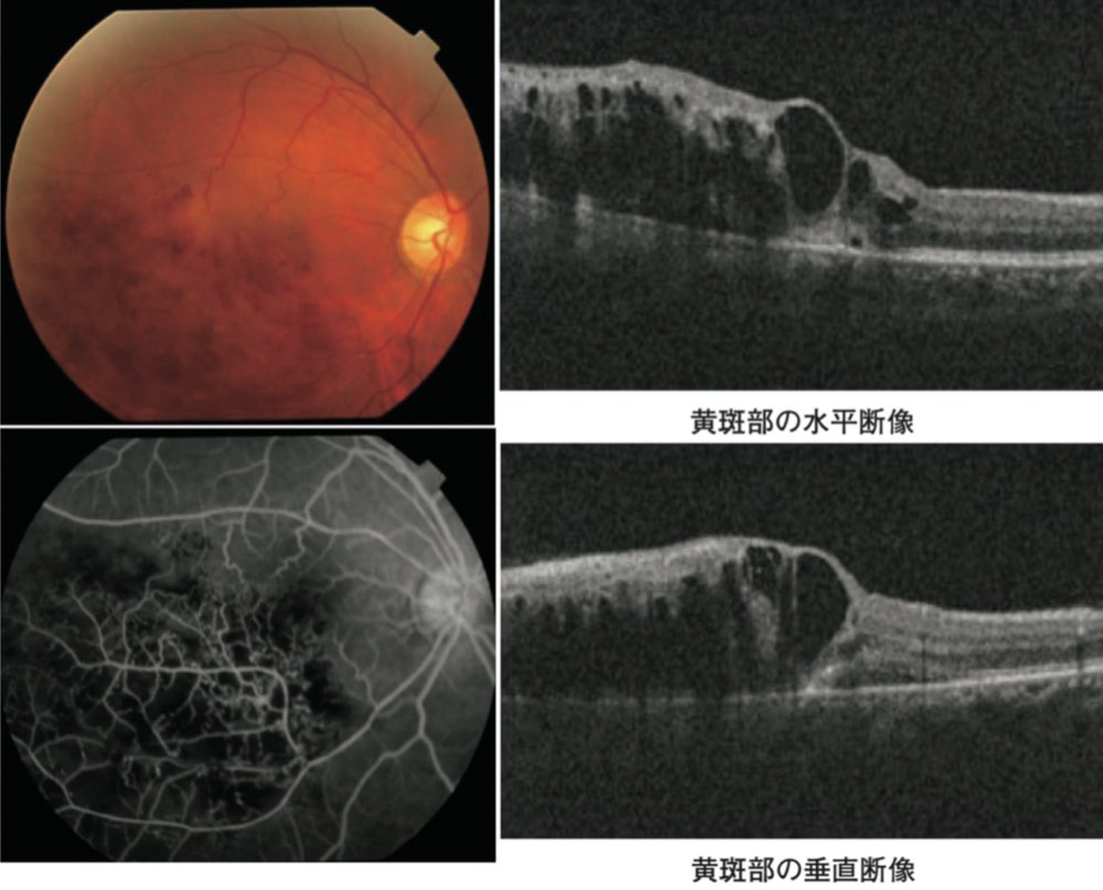 115D19の問題画像
