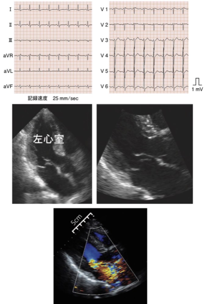 116F65の問題画像