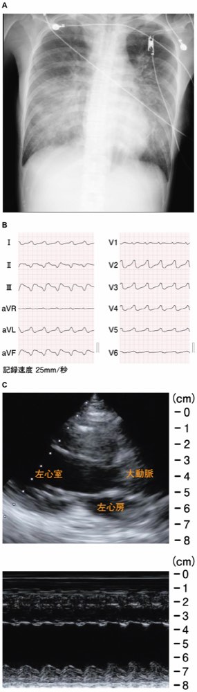 112A28の問題画像