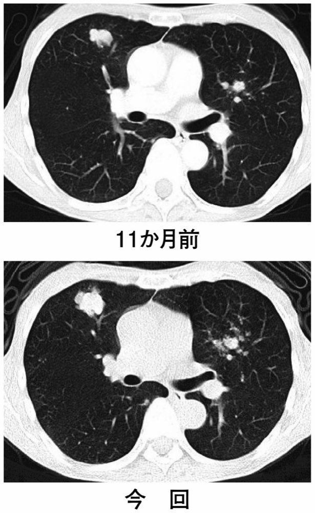 112D23の問題画像