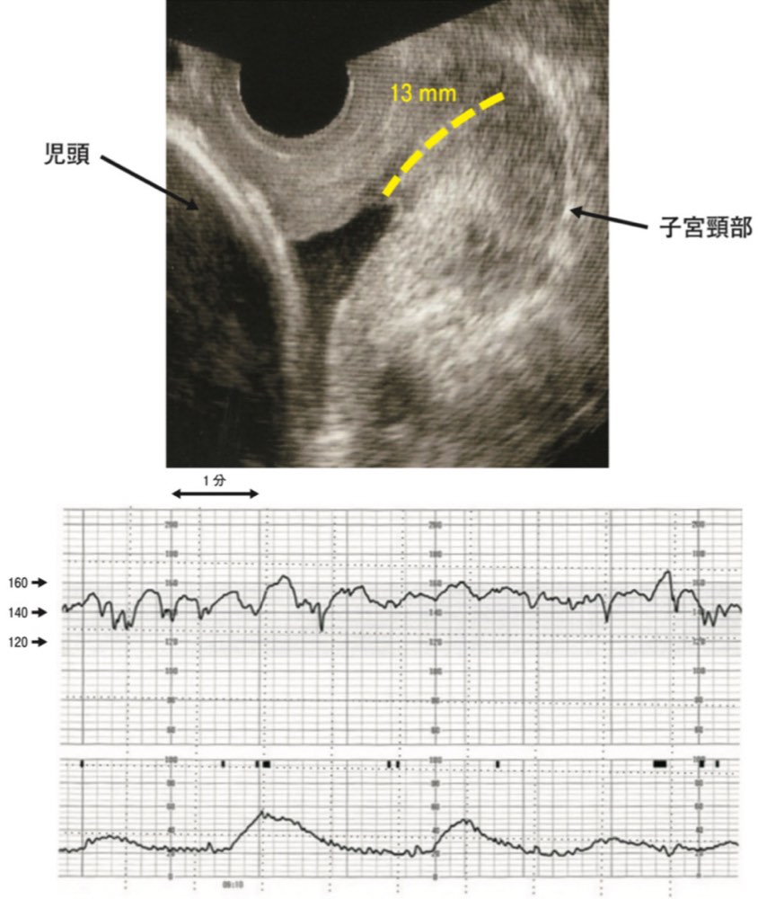 115F58の問題画像