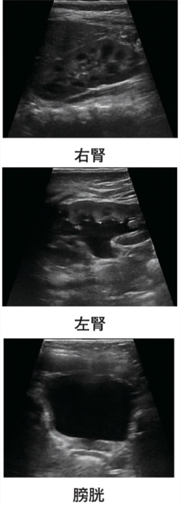 115A20の問題画像