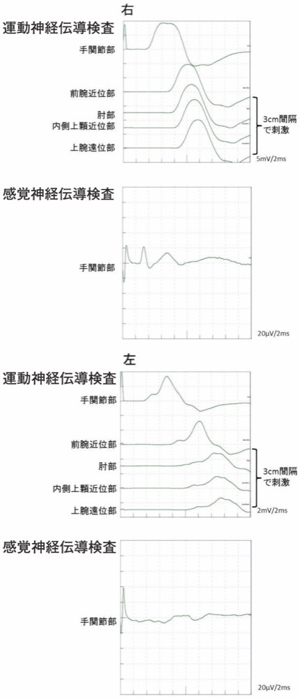 113D56の問題画像
