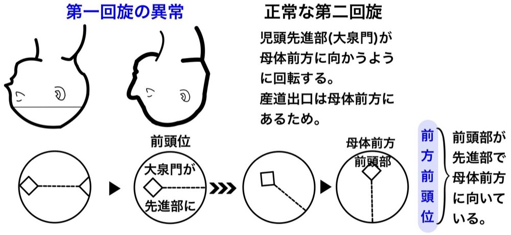 118F18の解説画像