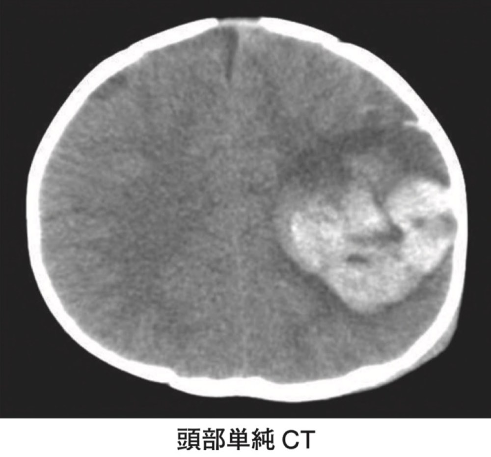116A17の問題画像