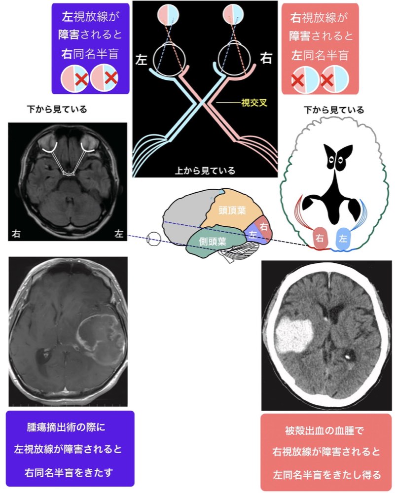 117D62の解説画像