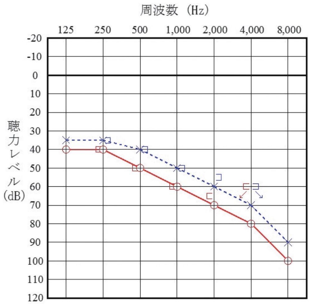 113F25の問題画像