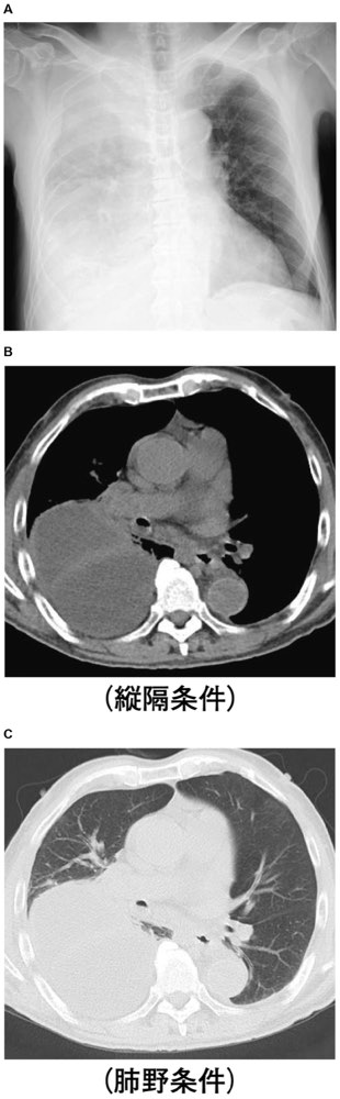 112E44の問題画像