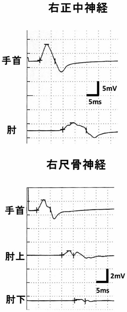 113A64の問題画像