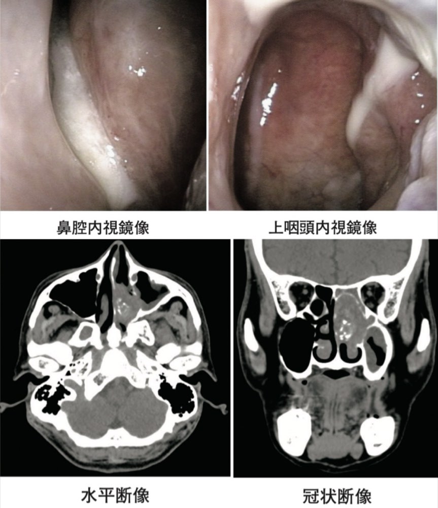 115D20の問題画像