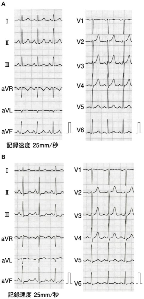 112D50の問題画像