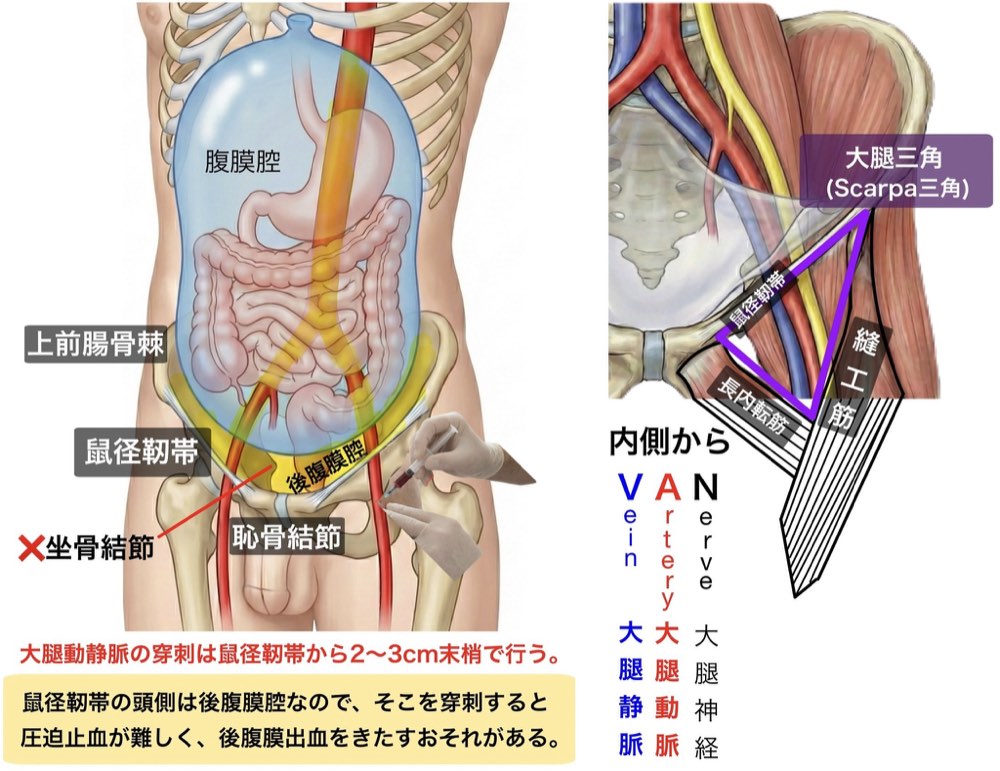 119F2の解説画像