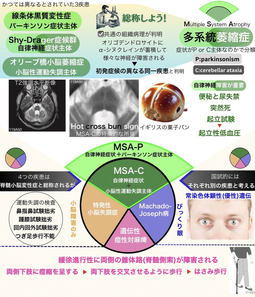115B14の解説画像