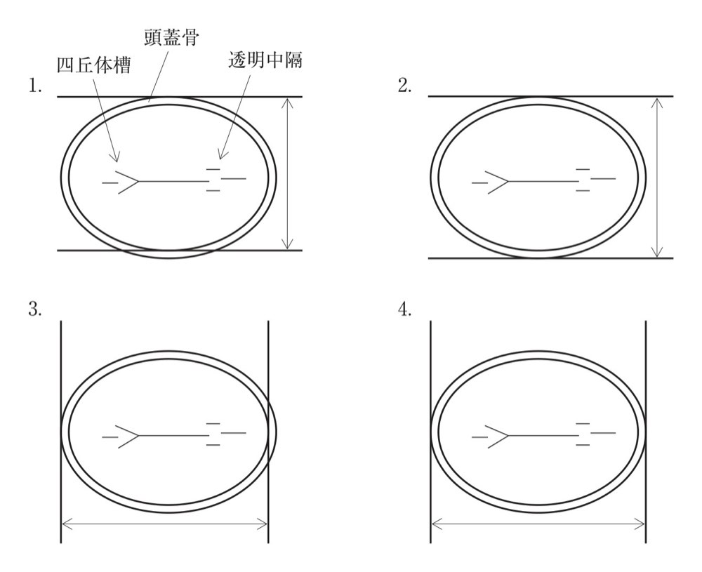 107PM010の問題画像