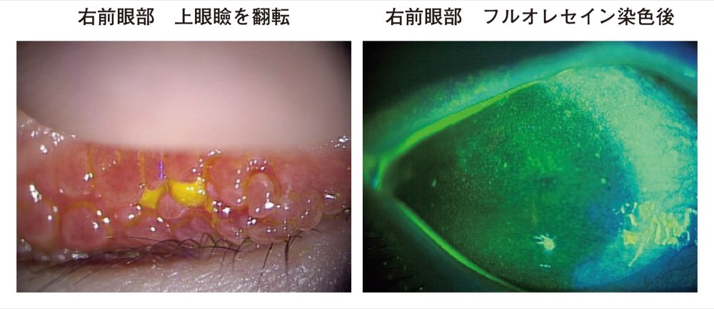 54PM071の問題画像