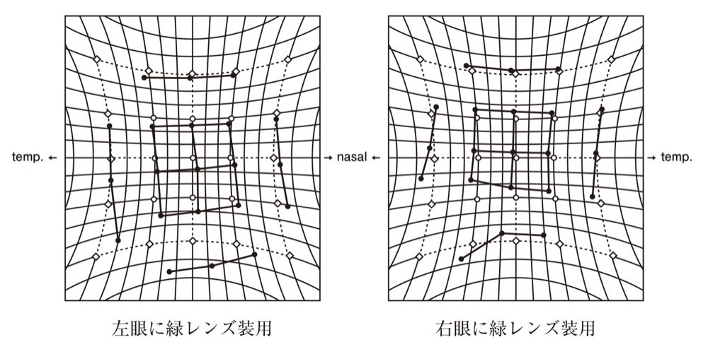 45AM052の問題画像
