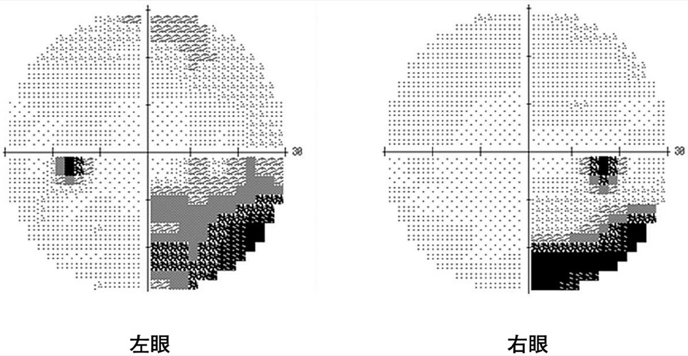 47AM072の問題画像