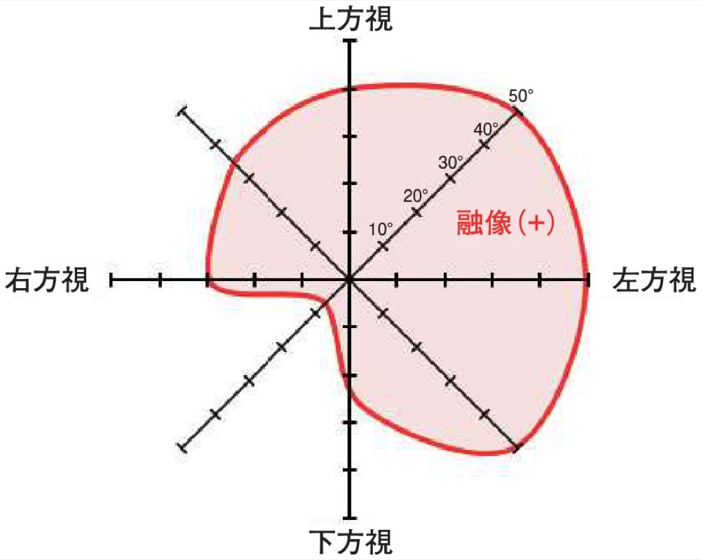55AM034の問題画像