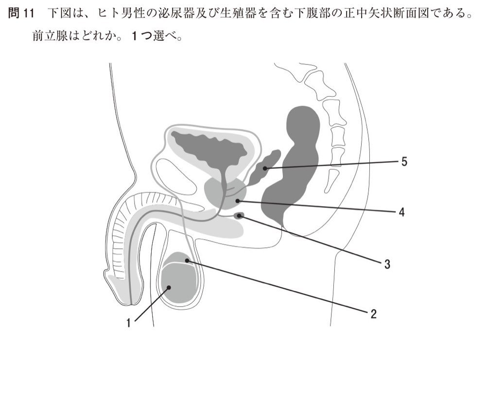 111Q011の問題画像