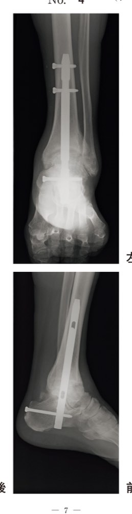 59AM017の問題画像