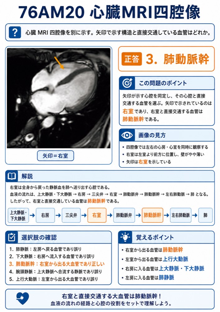 76AM20の解説画像