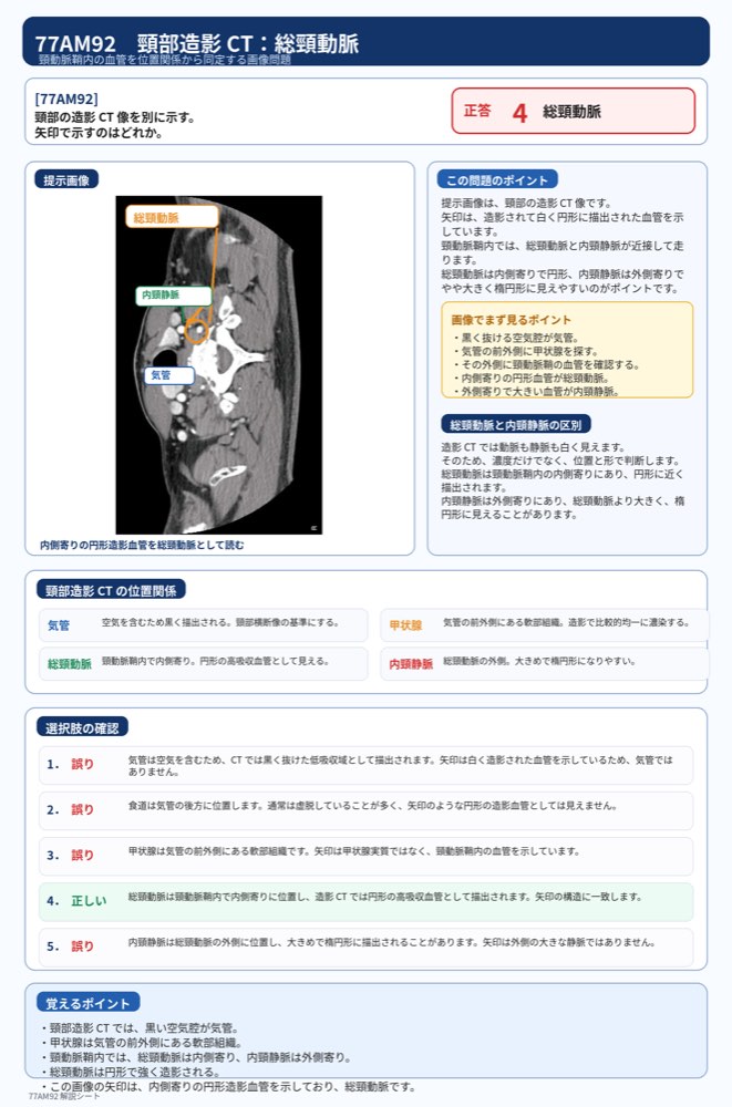 77AM92の解説画像