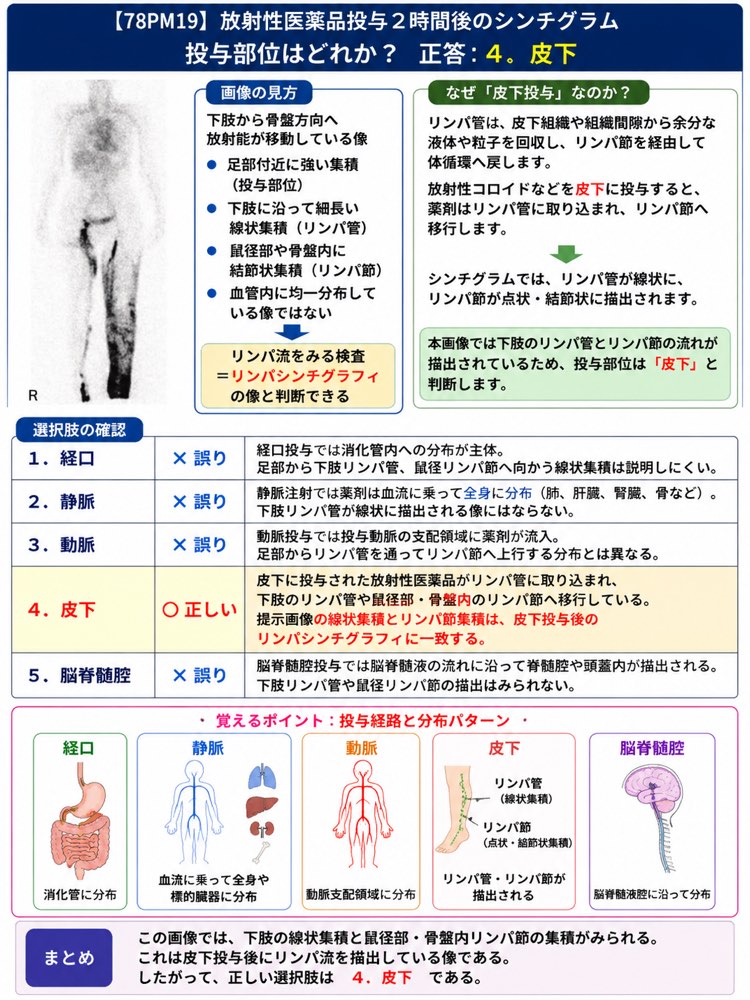 78PM19の解説画像