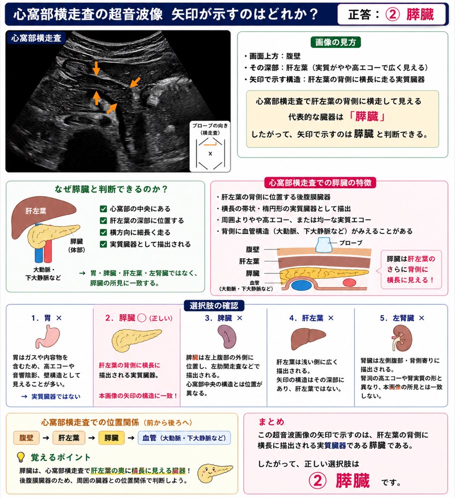 78PM10の解説画像