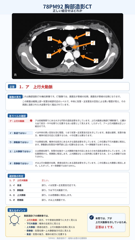 78PM92の解説画像