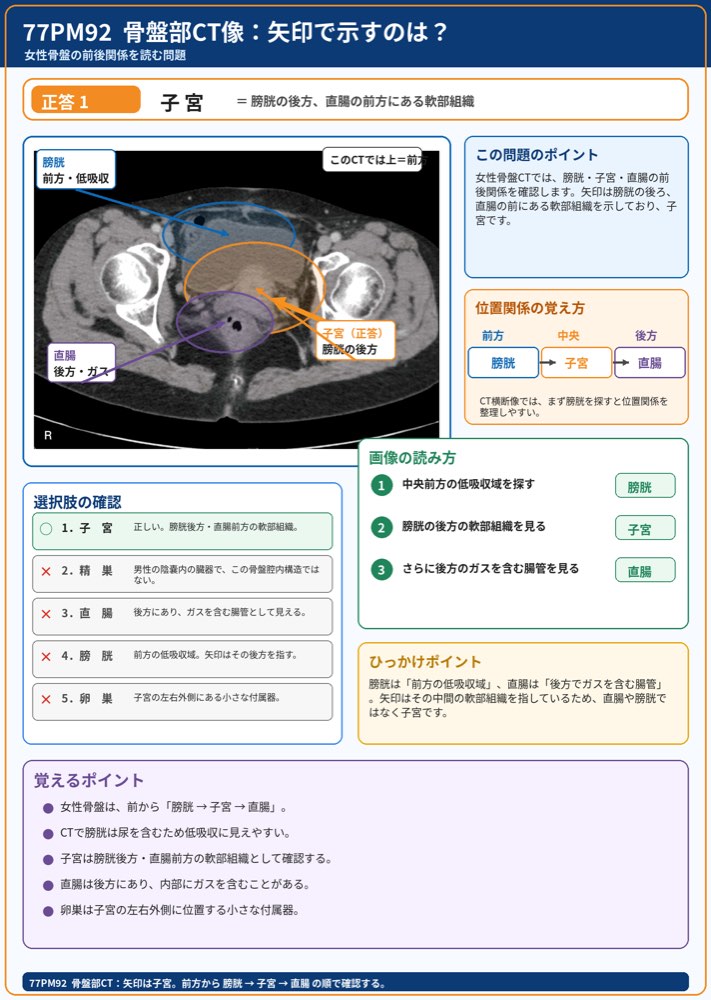 77PM92の解説画像