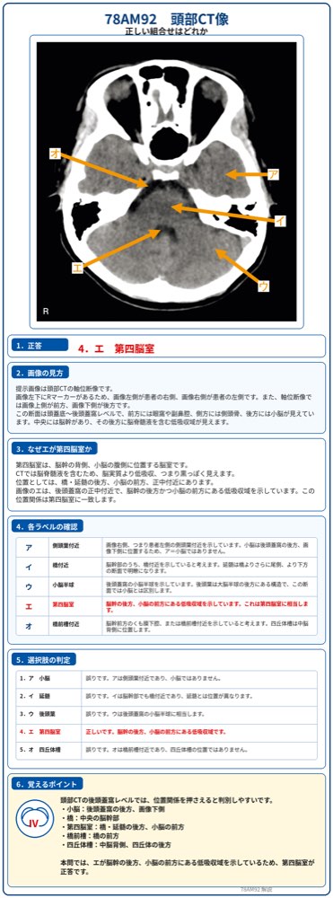 78AM92の解説画像
