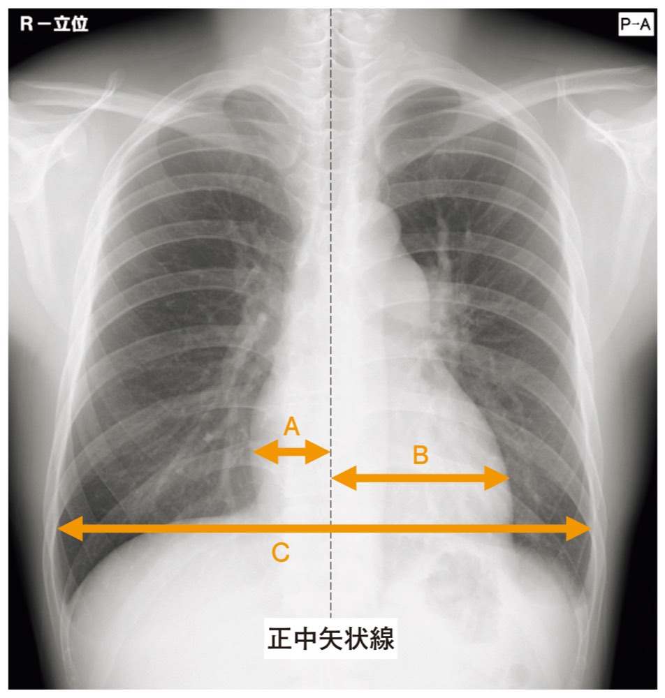 78AM90の問題画像