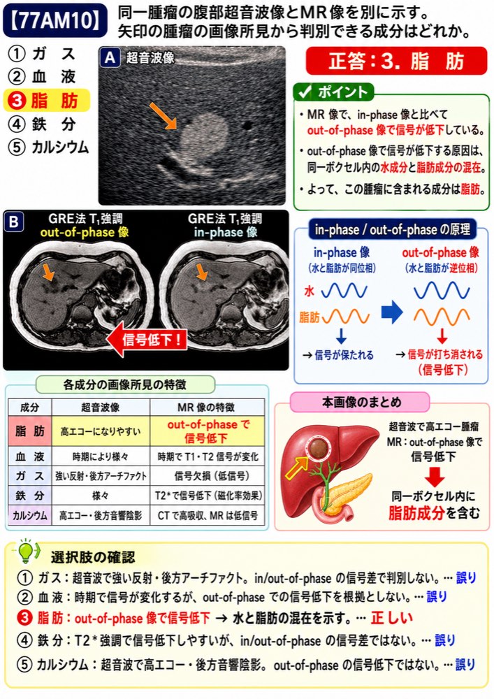 77AM10の解説画像