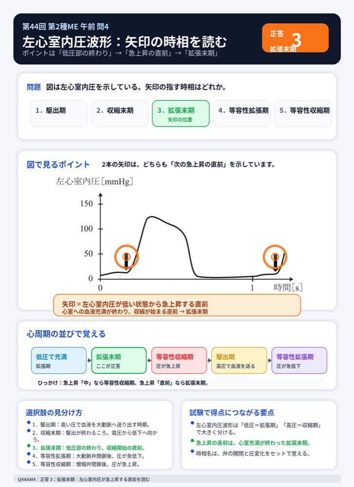 44AM4の解説画像