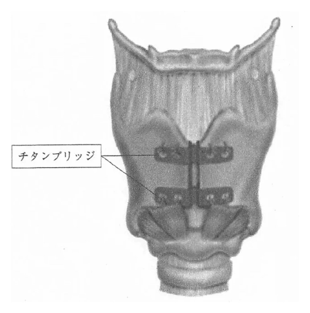 28AM077の問題画像